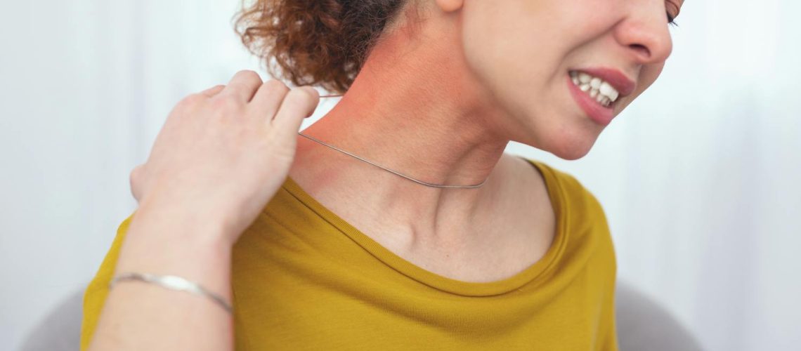 Tout savoir sur l'allergie au nickel